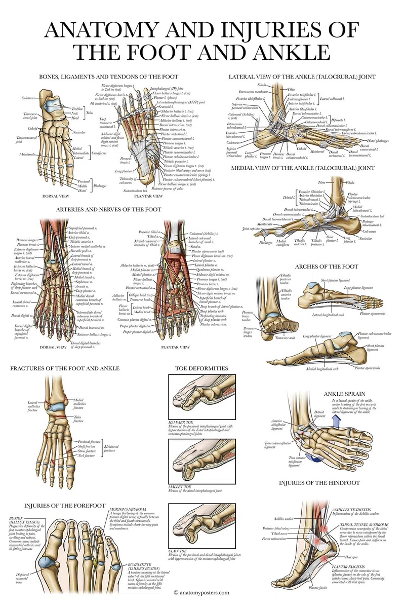 Palace Learning Planche anatomique plaquée sur l'anatomie et les blessures du pied et de la cheville - Schéma anatomique de l'articulation du pied et de la cheville - 45,7 x 61 cm