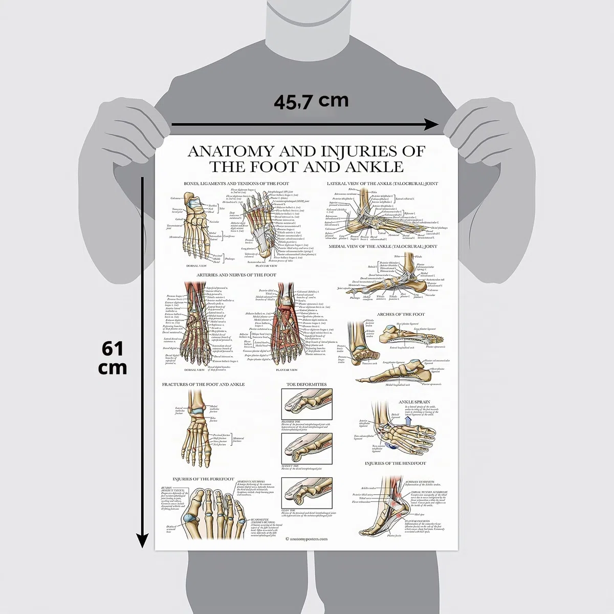 Palace Learning Planche anatomique plaquée sur l'anatomie et les blessures du pied et de la cheville - Schéma anatomique de l'articulation du pied et de la cheville - 45,7 x 61 cm
