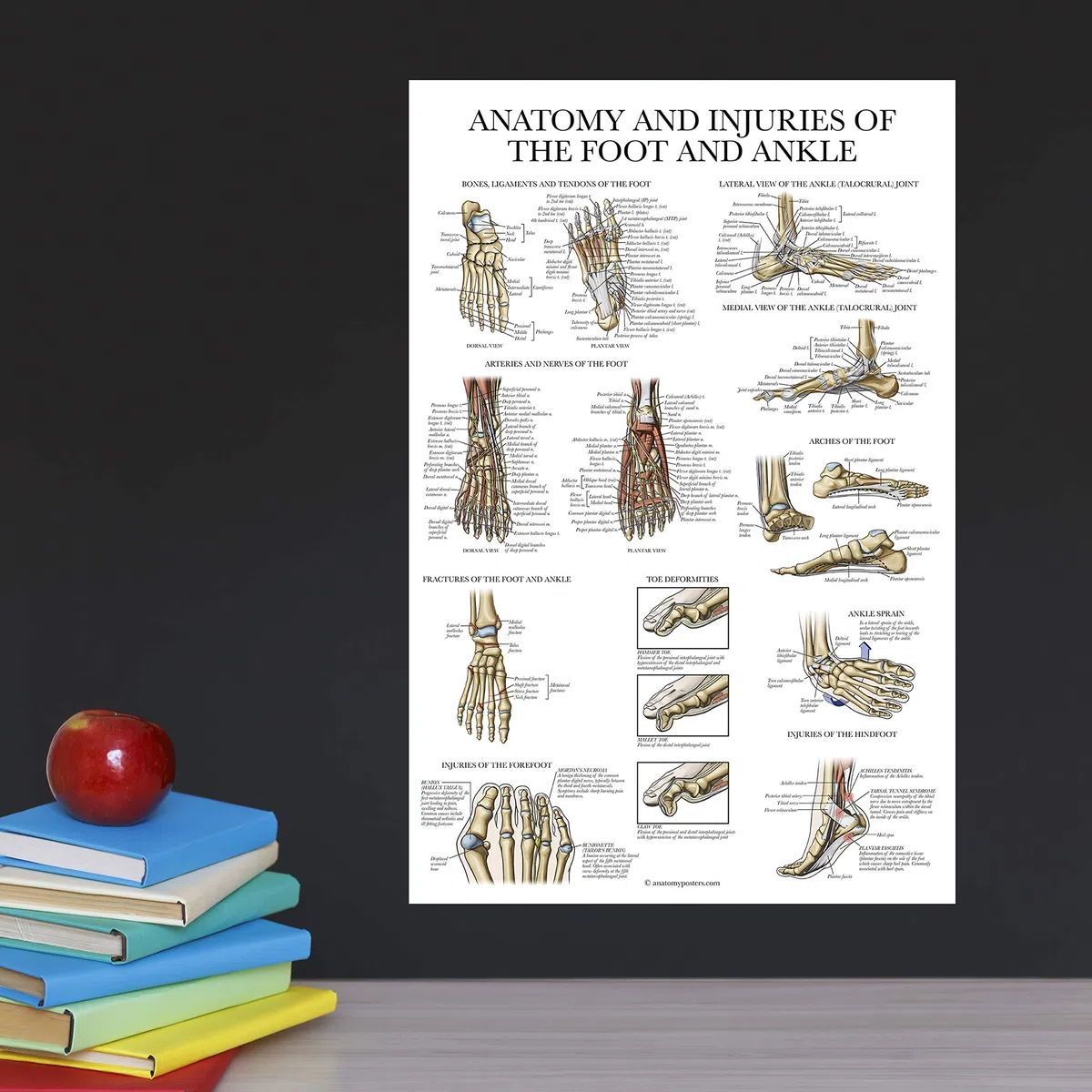Palace Learning Planche anatomique plaquée sur l'anatomie et les blessures du pied et de la cheville - Schéma anatomique de l'articulation du pied et de la cheville - 45,7 x 61 cm